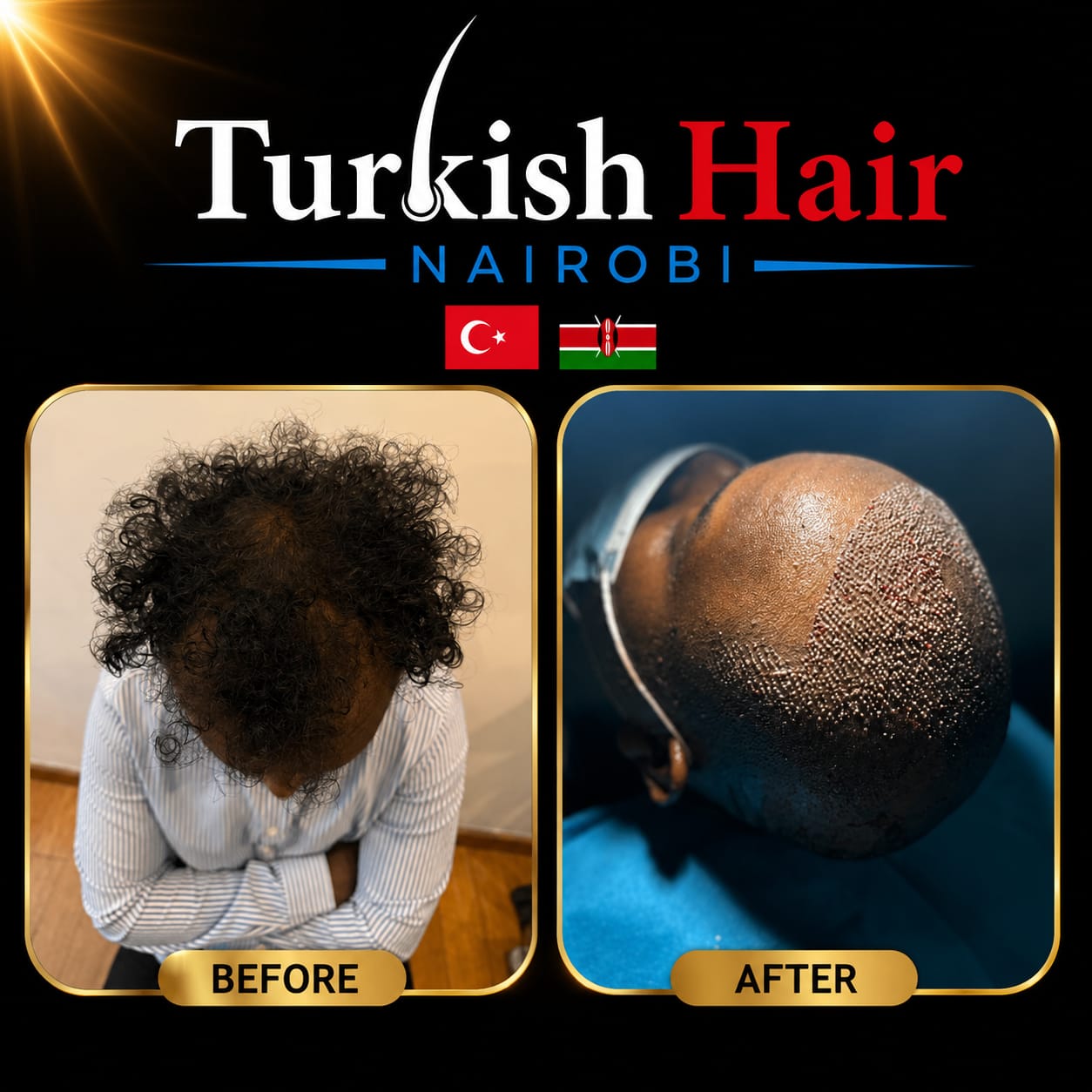 Turkish Hair Nairobi Case 9
